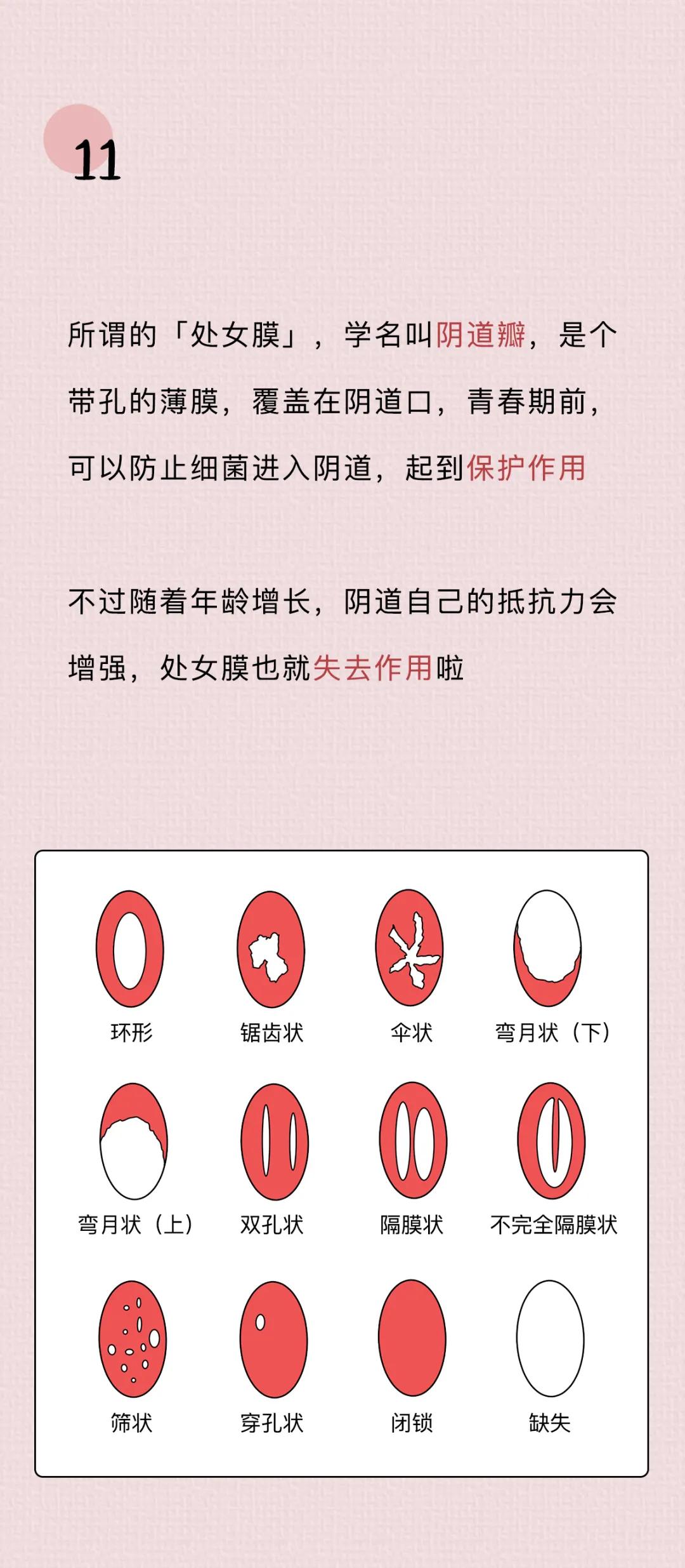 女性阴道生理科普知识大全,女性阴道生理科普知识大全100题