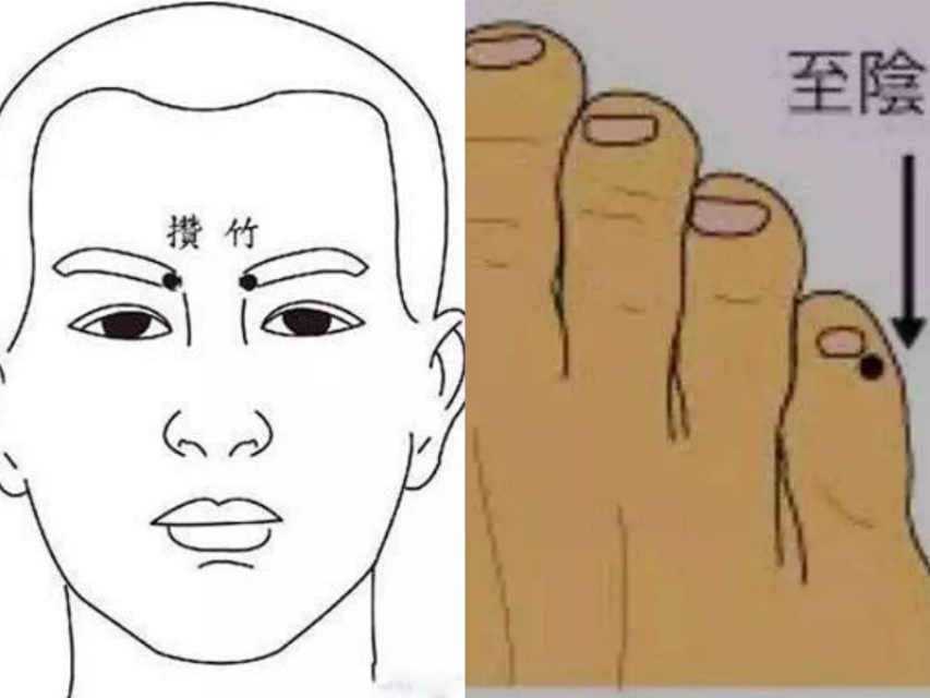 于书庄针灸,于书庄针灸视频