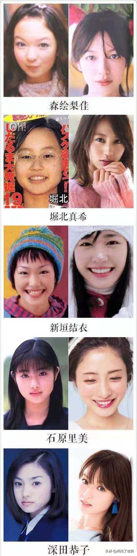 石原里美和佐藤健,石原里美整容之路
