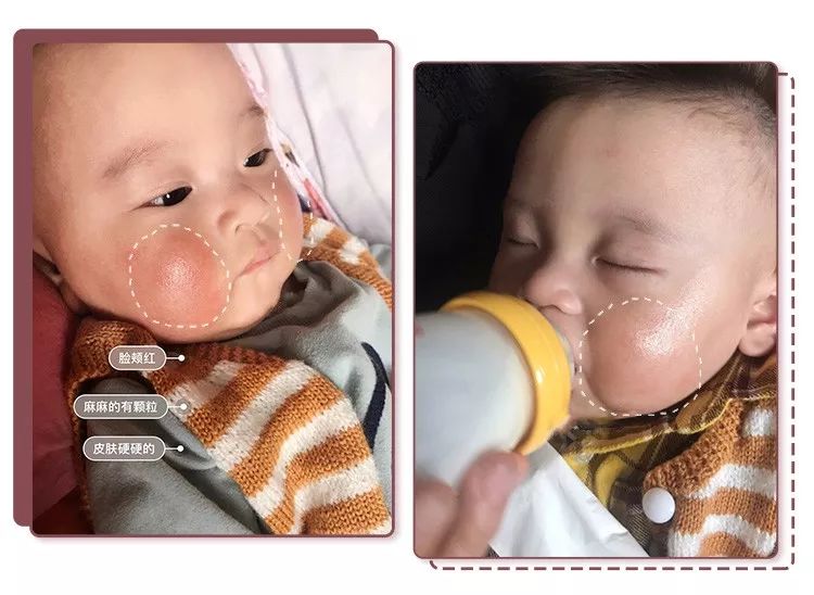 蔡依林皮肤特护霜,蔡依林胶原蛋白粉保养皮肤