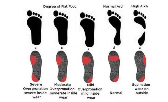 跑步对膝盖脚踝保护好的跑鞋,适合脚踝力量弱的跑鞋