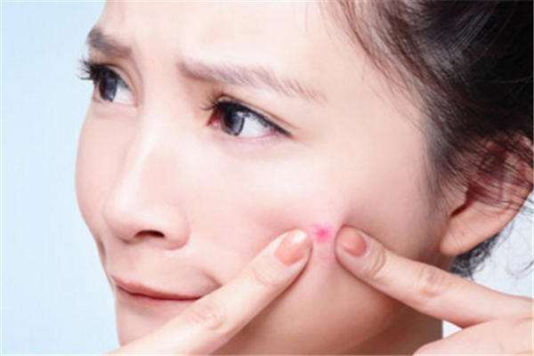 脸上长痘痘可以敷面膜吗,长痘痘期间能用维生素e敷面膜吗