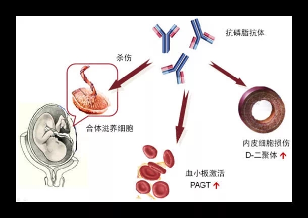 预防阿司匹林引起的出血,预防阿司匹林剂量25毫克够用吗