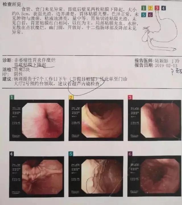 病人经常呕吐是什么原因,频繁嗳气一年了是大病吗