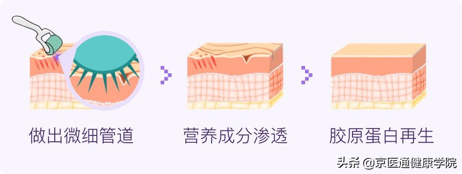 毛孔粗大的原因及改善方法,毛孔粗大的原因和治疗方法