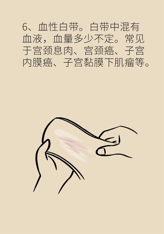 这个问题每个女生都有，知道预防是关键！