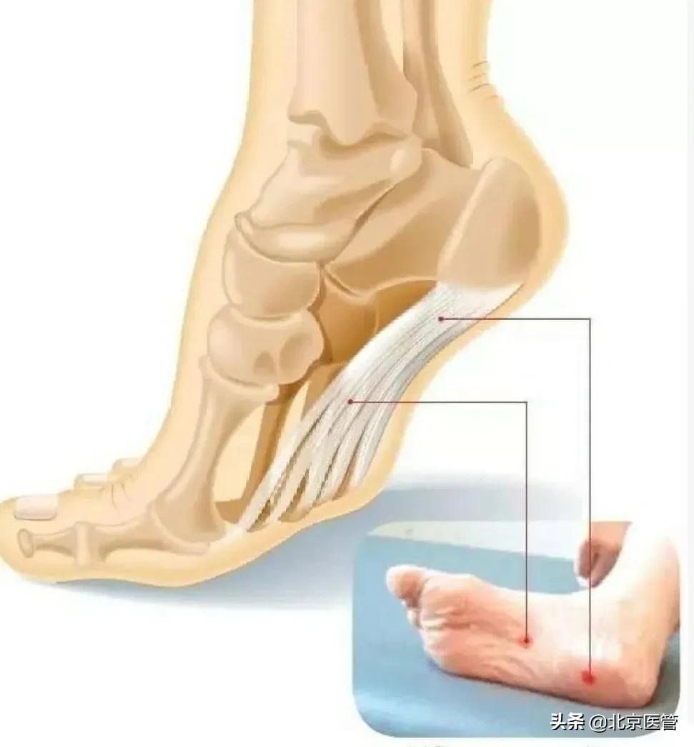 脚不定位经常有针刺的感觉,脚一踏在地上就塌下去