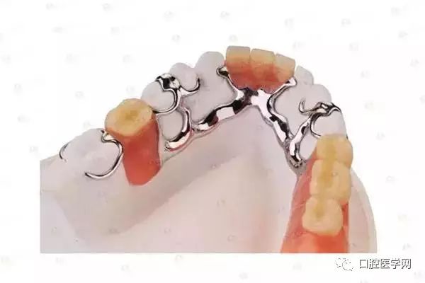 缺牙不镶牙你不知道的危害,缺牙不镶牙的不良影响示意图