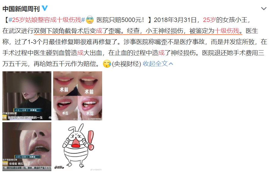 年纪越大脸就会越小是真的吗,如何判断自己是鹅蛋脸还是方脸