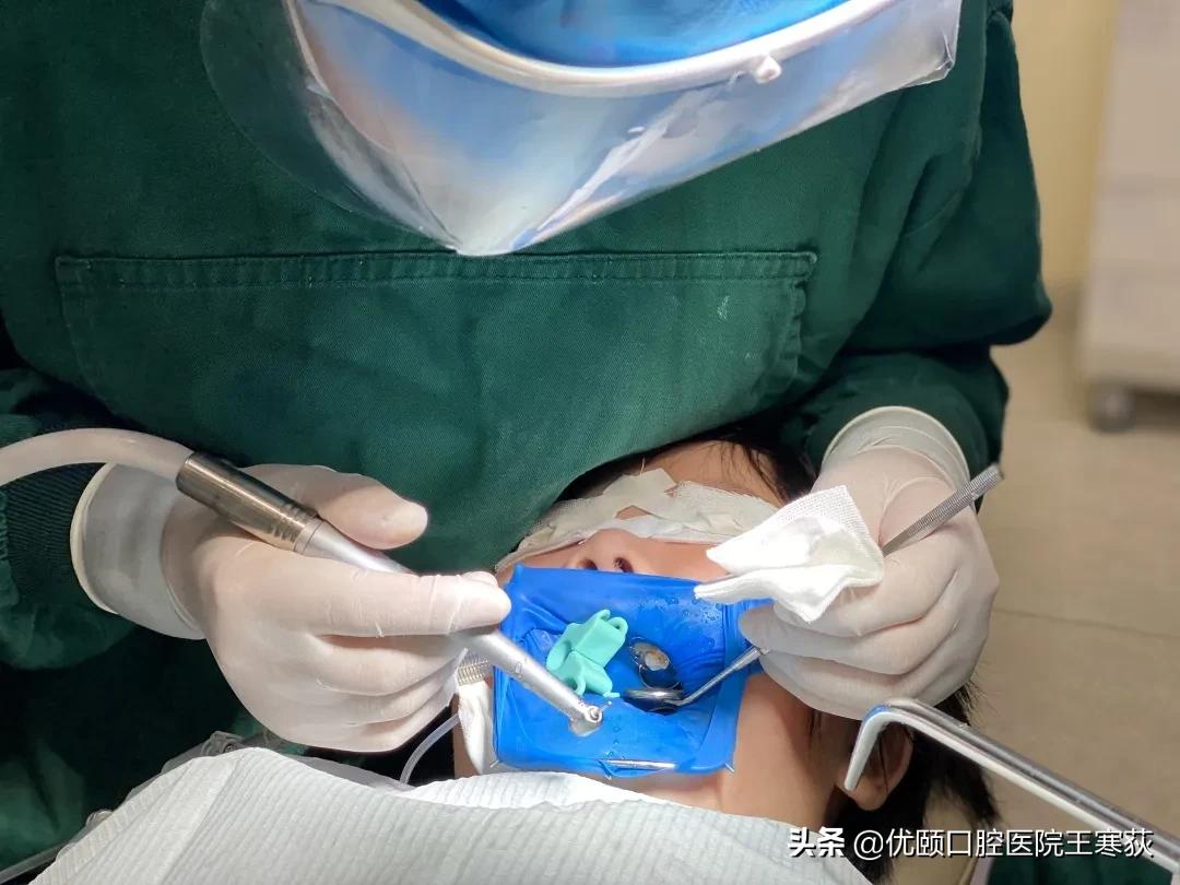 儿童全麻治疗过程,三岁宝宝根管治疗全麻有危害吗