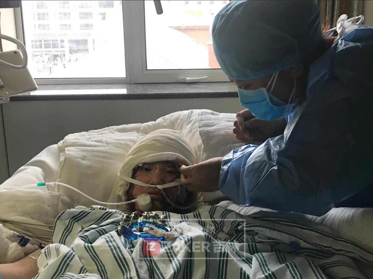 已做完第四次手术状态平稳铭医专家团表示愿意免费帮她修复容颜