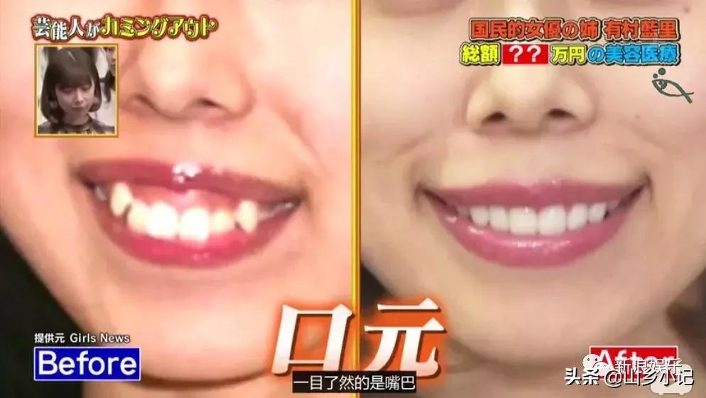 明明是整容脸现在却成了颜值巅峰,明明是整容脸却没被吐槽过