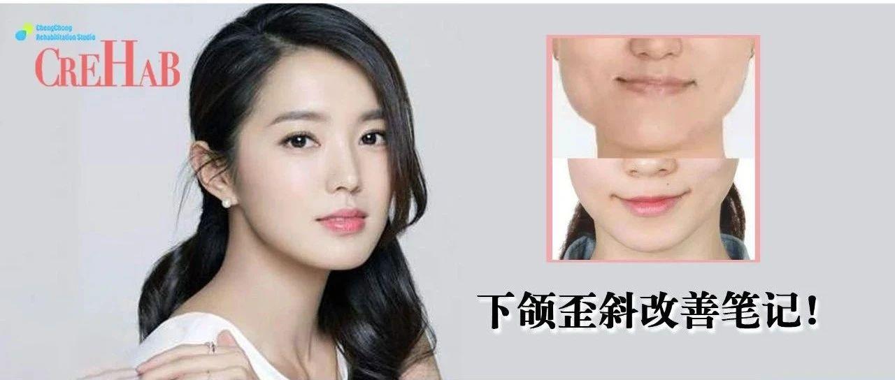 大小脸特别严重脸歪,脸歪严重面相