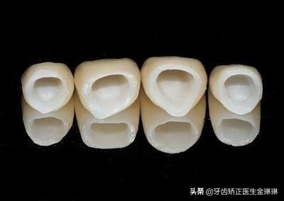 山东最便宜的烤瓷牙,18年北京烤瓷牙价格是多少