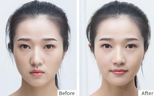 法令纹真的难看吗？奥黛丽赫本的法令纹这么迷人！你也可以做到