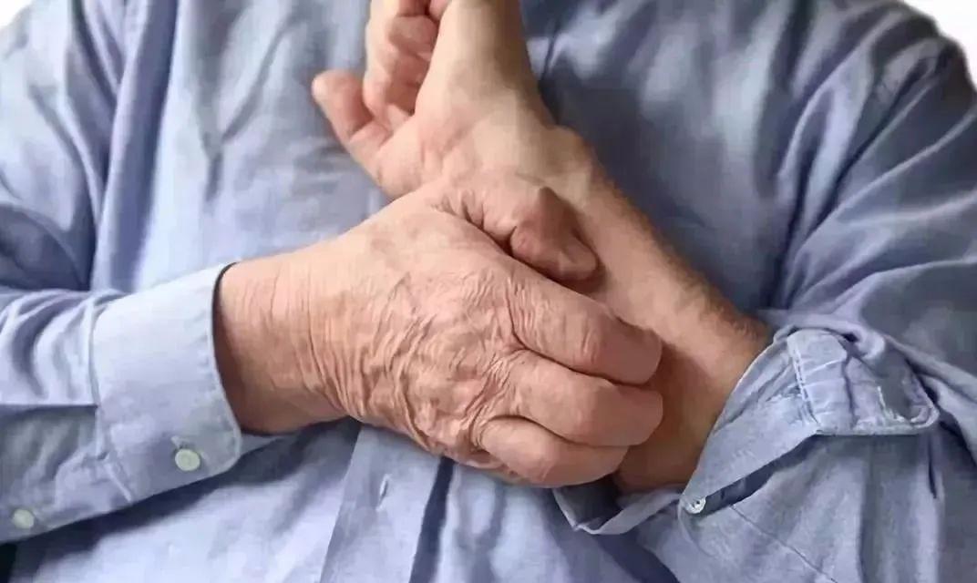 连圈状秕糠疹的患者，在腹部和腰部有症状，早发现就医或许能根除