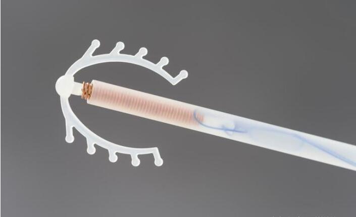 节育环长到肉里怎么取不出来摘,节育环戴11年了能引起出血吗