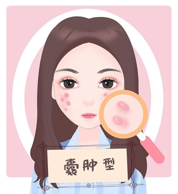 青春痘的中医辨证及治疗,青春痘的中医疗法视频