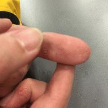 手上有三个有代表什么,中医看手掌怎么看出肺有问题