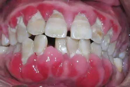 禁毒知识毒品的危害答案,禁毒知识资料毒品的危害