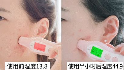 用这款植物香皂洗脸，3周除螨93.77%，痘痘明显改善，湿润不紧绷