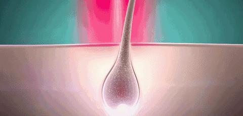 3天不洗头头皮特别多,3天不洗头头皮好臭