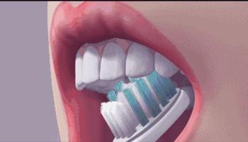 一张“示意图”告诉你，牙不好是怎样连累心血管的…