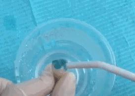 进行防龋齿牙齿窝沟封闭工作,窝沟封闭是保护牙齿最有效的方式