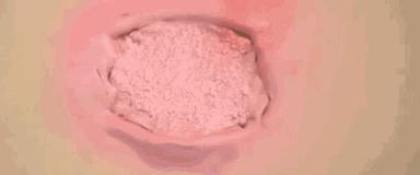 比创可贴好用,最好用的液体创可贴