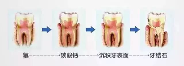 新西兰红印美白牙膏,去牙齿黄渍最好的国外牙膏牌子