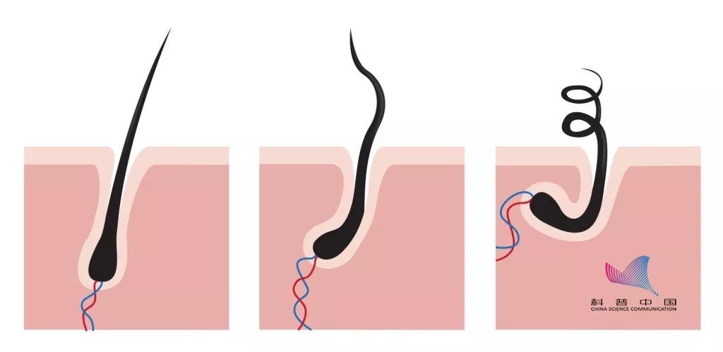 掉多少根头发才算脱发,一天掉多少根头发叫脱发