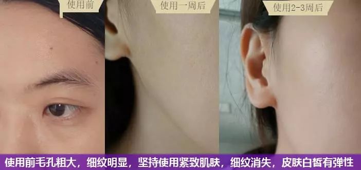 23岁后的女人用点好的！只需599元的SV冻龄水为何被誉为欧洲女性的驻颜神器？SV冻龄水胜于神仙水天然安全高效