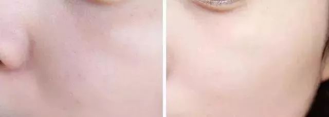 喷一喷,黑头油脂自动溶解!日本爆款清洁喷雾还你一个嫩*b嫩**aby肌!