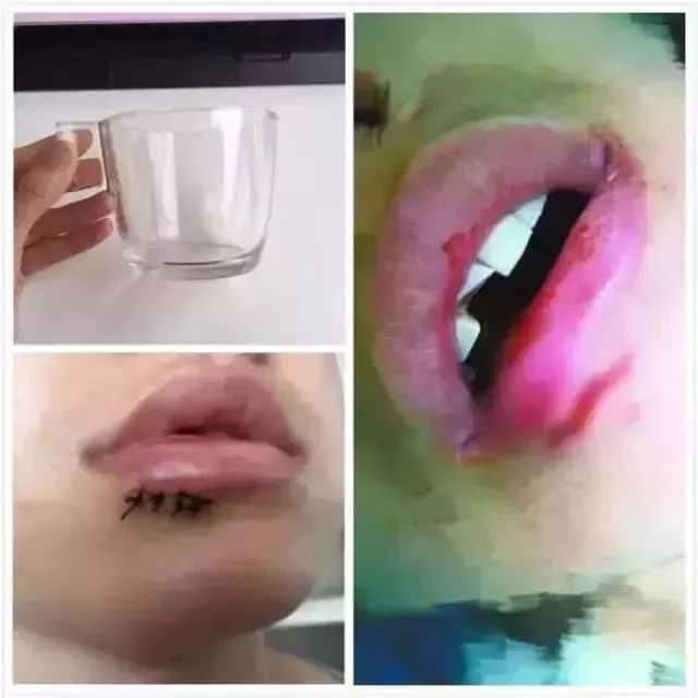 水杯爆裂宜家赔吗,宜家杯子爆炸事件