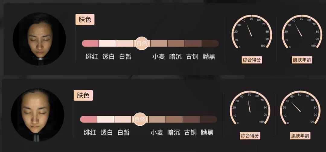 灏忚寕鑲岃瘖瀹ゅ埌搴曟湁澶氬己,灏忚寕鑲岃瘖瀹よˉ姘村悧