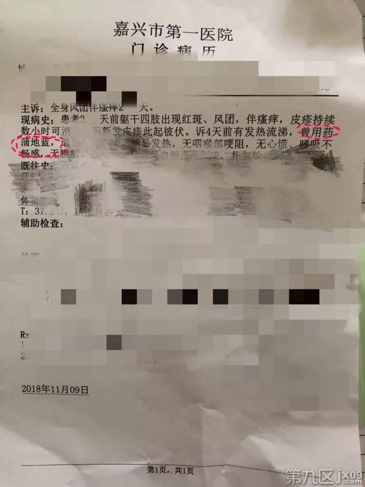 孩子吃感冒药过敏起了红疹图片,孩子吃感冒药后脸上有红点点