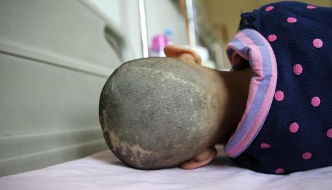 12岁孩子尿毒症父亲后悔痛哭,11岁男孩肾癌患癌晚期