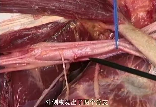 康复人必学的解剖教程/视频/电子书大合集，点击领取