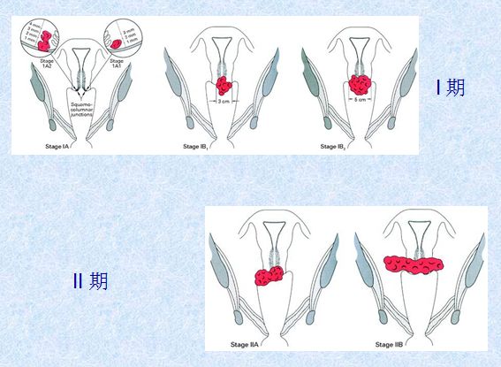 女生对不起我错了的视频,女生说对不起是我的错