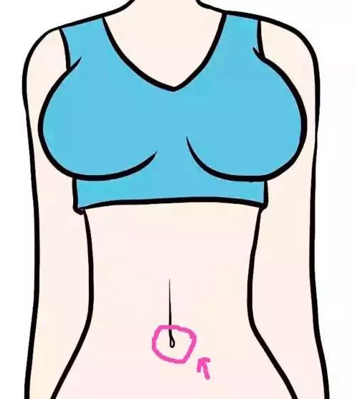 做妇科手术可以修复腹直肌吗,没有疤痕的妇科手术是啥