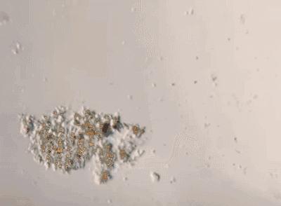 无痕裤为什么无痕,内衣裤处瘙痒小妙招