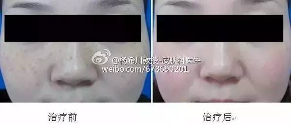 让你轻松告别色斑的困扰,告别暗沉淡化色斑