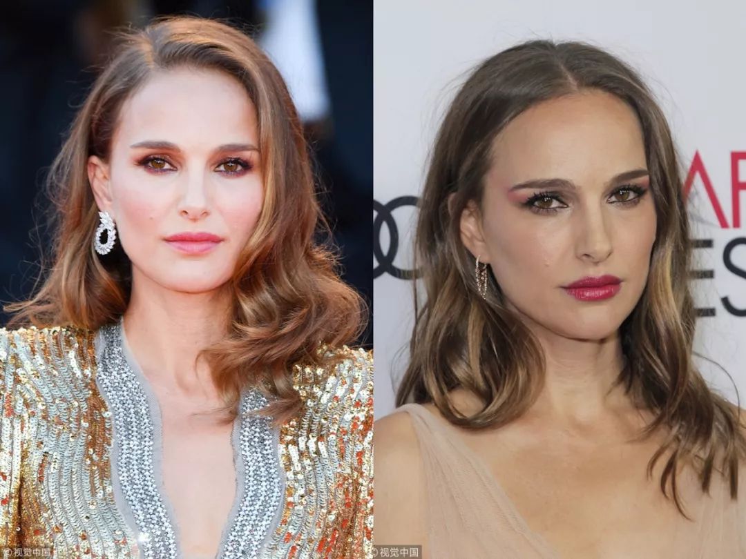 去掉眼袋之后天壤之别,无美颜无滤镜遮泪沟眼袋