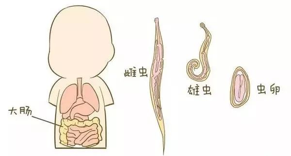 一女子持续便血、头晕两个月！竟与之前的一次旅游有关！常去户外的都要注意……