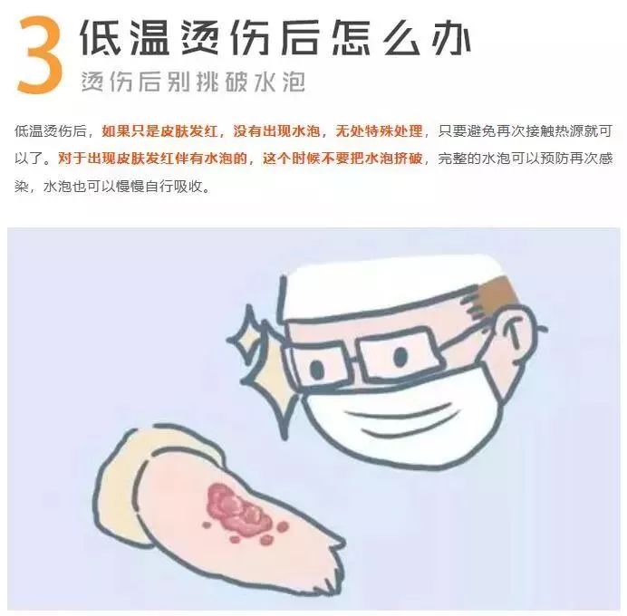 电暖宝多少度会引起低温烫伤,防烫伤电暖器