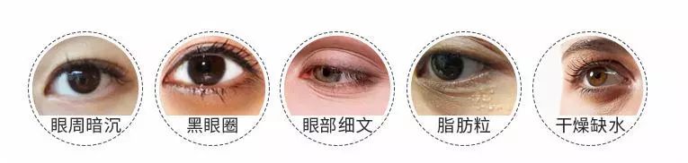 韩国品牌眼霜补水保湿,推荐一款韩国好用的眼霜