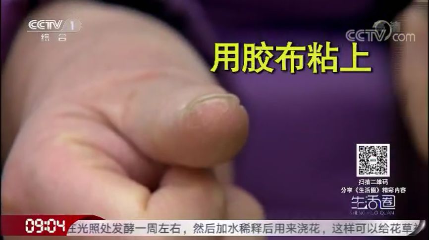 一到冬天手脚起皮干裂怎么治,冬天手脚干裂一招轻松缓解