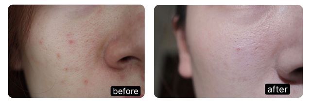 拼团秒杀素颜霜,拼团乳霜