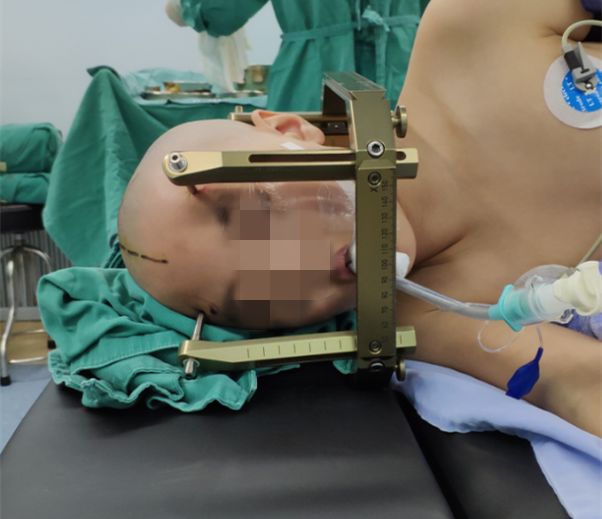 赞！重庆三博江陵医院成功开展脑干占位立体定向活检术！