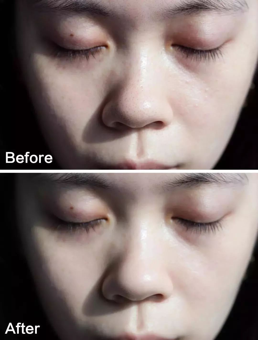 涂脸上能吸出脏东西,吸脸上毛孔里脏东西好吗